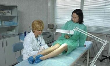 como tratar as varices nas pernas