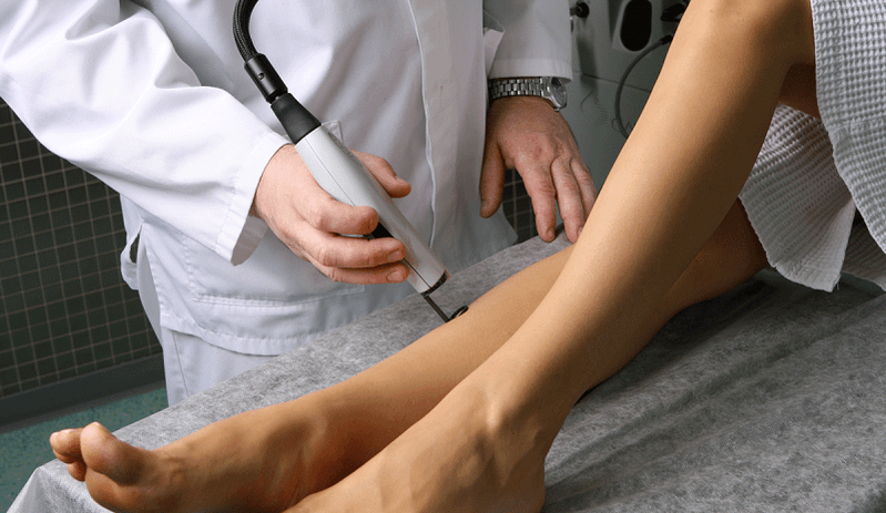 tratamento con láser para varices